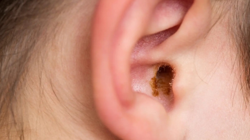 Không lấy ráy tai cho trẻ có sao không? Trường hợp nào nên lấy ráy tai cho bé? 1