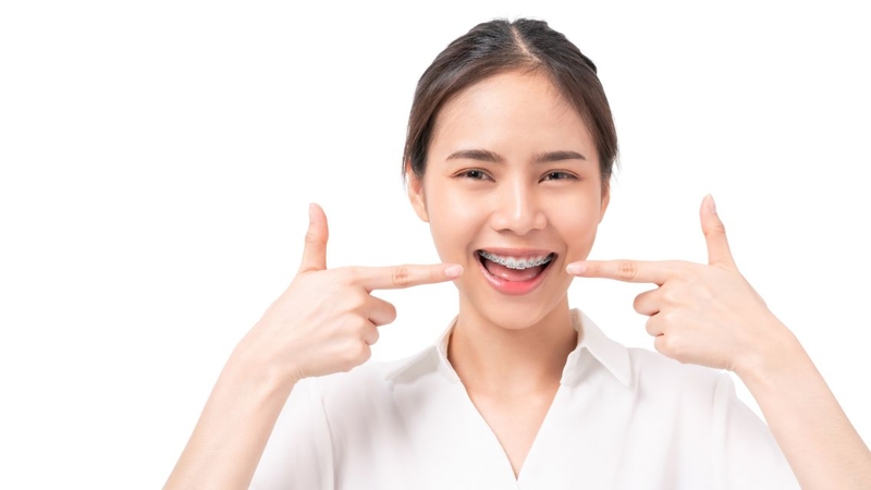 Thế nào là khớp cắn ngược nhẹ? Nguyên nhân, nhận biết và cách điều trị 4