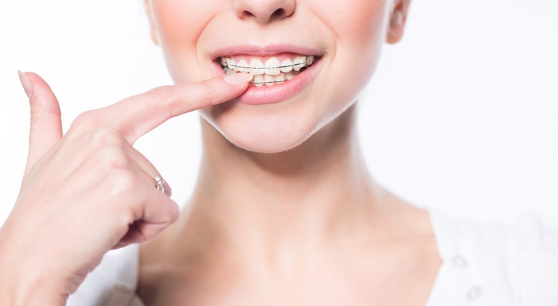 Khớp cắn sâu là gì? Nguyên nhân gây khớp cắn sâu 3