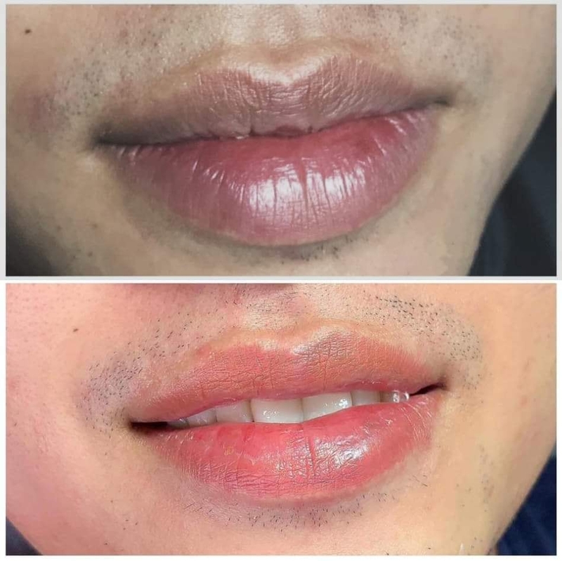 Phun môi khử thâm giúp bạn có đôi môi hồng tự nhiên