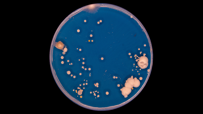 Đếm số lượng khuẩn lạc bằng cách quan sát trên đĩa Petri