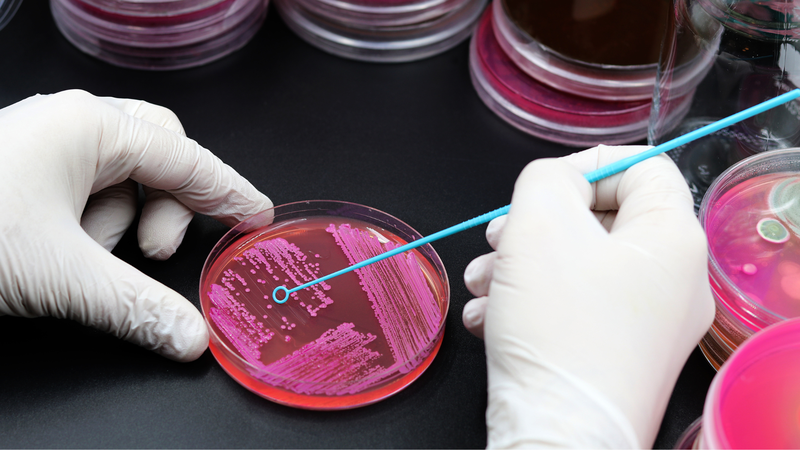 Khuẩn lạc đóng vai trò quan trọng trong nghiên cứu vi sinh học
