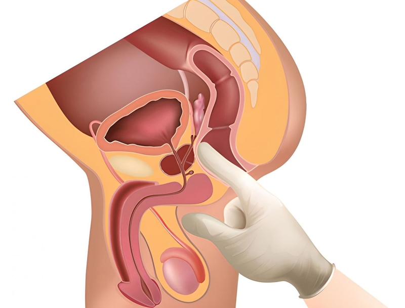 Kích thích tuyến tiền liệt có tác dụng gì? Hướng dẫn cách kích thích tuyến tiền liệt 4