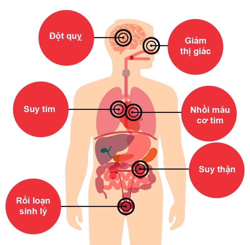 Kiểm soát huyết áp siêu chuẩn với máy đo huyết áp Nhật Bản của thương hiệu Omron