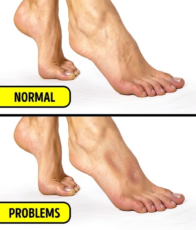 7 cách đơn giản giúp bạn tự kiểm tra sức khỏe tại nhà 7