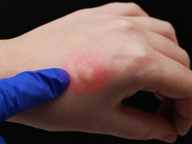 bi-kien-can-sung-phu-phai-lam-sao-1