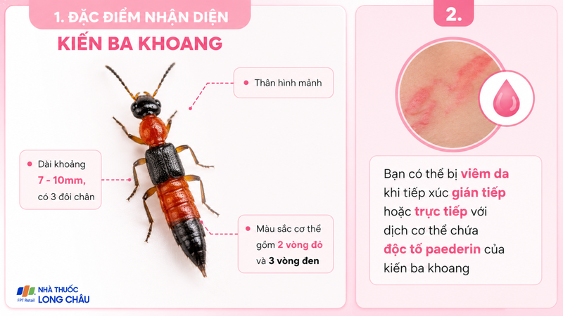 Viêm da tiếp xúc do kiến ba khoang là tình trạng thường gặp vào mùa mưa bão