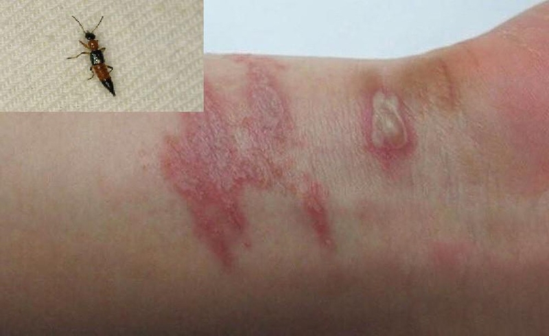 Kiến ba khoang nguy hiểm như thế nào 3