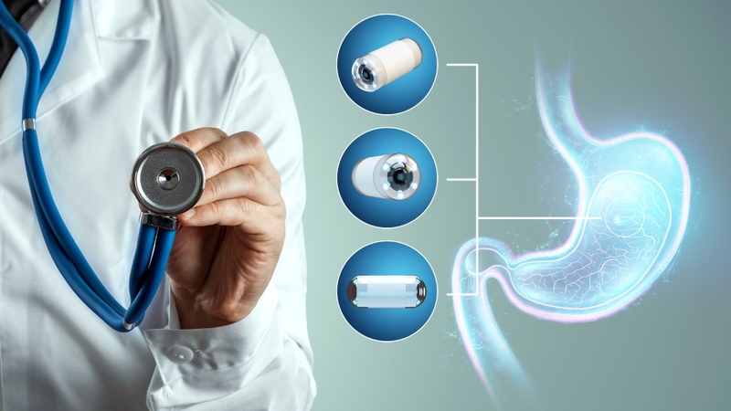 Kinh nghiệm nội soi dạ dày và điều chú ý cho bệnh nhân 4