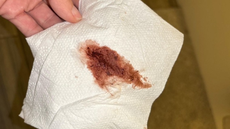 Nhiều phụ nữ thắc mắc kinh nguyệt màu nâu có thai không