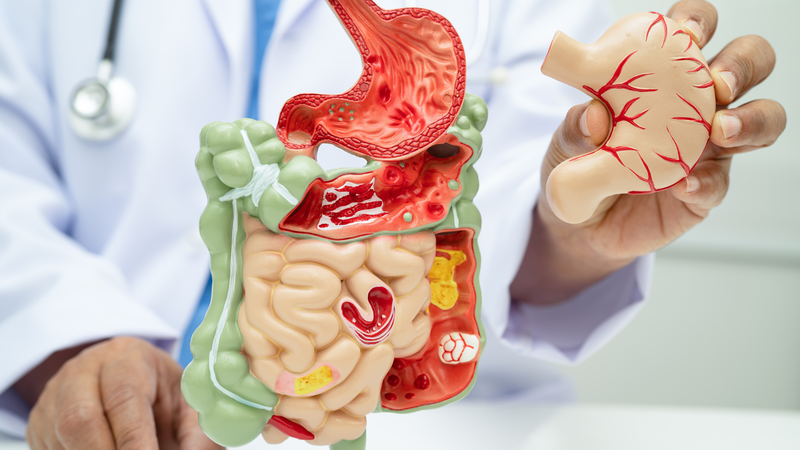 Góp phần giúp hệ tiêu hóa khỏe mạnh