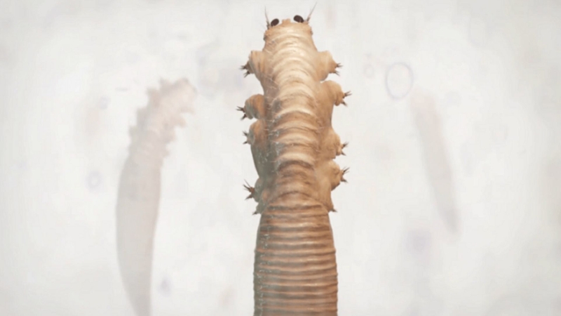 Ký sinh trùng Demodex là một loại ký sinh trùng tồn tại tự nhiên trên da