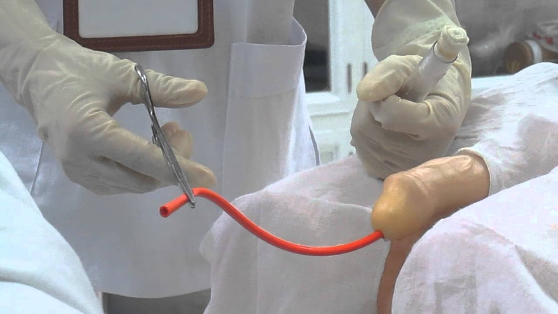 Kỹ thuật bơm rửa bàng quang là gì? 1