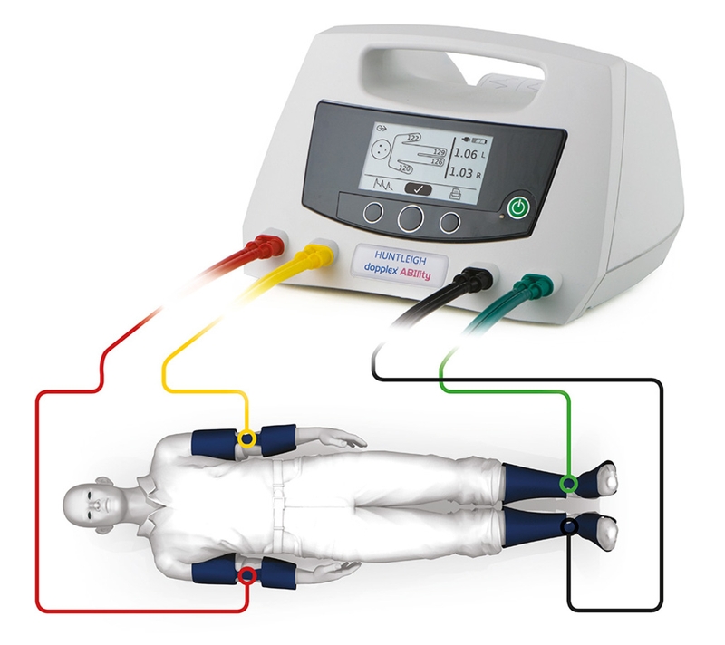 Kỹ thuật đo ABI là gì? Chỉ định và chống chỉ định của nghiệm pháp đo ABI 2