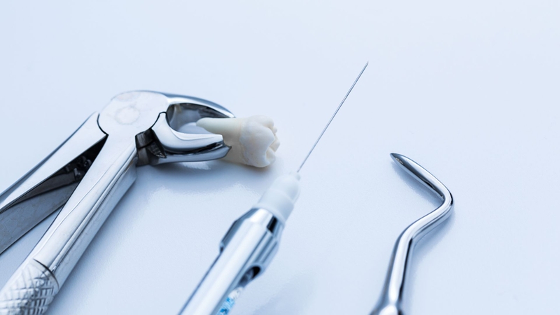 Kỹ thuật gây tê cận chóp là gì? Quy trình thực hiện thế nào? 1