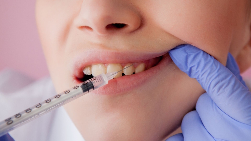 Kỹ thuật gây tê cận chóp là gì? Quy trình thực hiện thế nào? 4