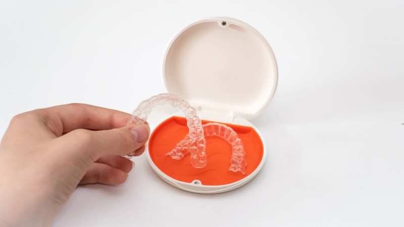 Kỹ thuật niềng răng vô hình là gì? Có hiệu quả không? 1