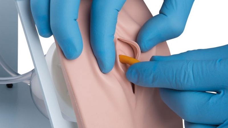 Hướng dẫn chăm sóc bệnh nhân đặt ống thông tiểu 1