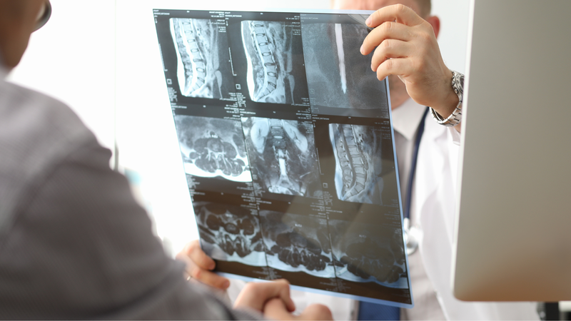 Kỹ thuật xạ hình xương SPECT/CT là gì? Khi nào nên thực hiện kỹ thuật này 1