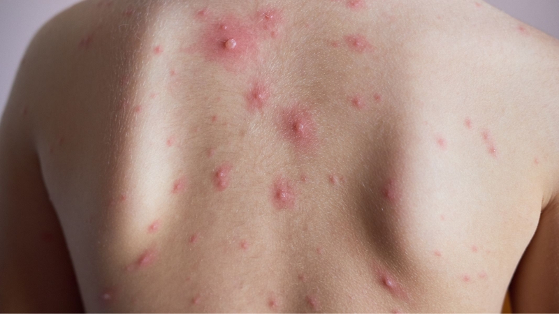 Không nên lạm dụng kỷ tử hoặc dùng liều cao trong thời gian dài vì có thể gây nóng trong, phản tác dụng