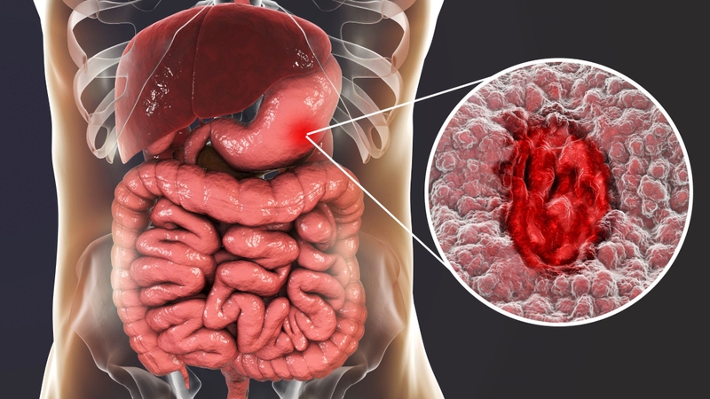 Không nên uống nước dừa hoặc nước lá lốt khi bụng đói vì có thể gây khó chịu cho dạ dày, đặc biệt với người có hệ tiêu hóa yếu