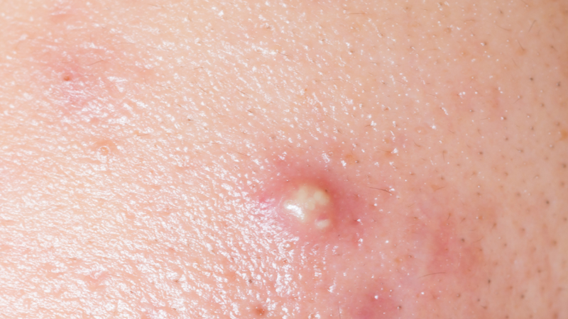 la-na-co-tac-dung-gi-trong-dieu-tri-benh-va-suc-khoe-tong-quat 2