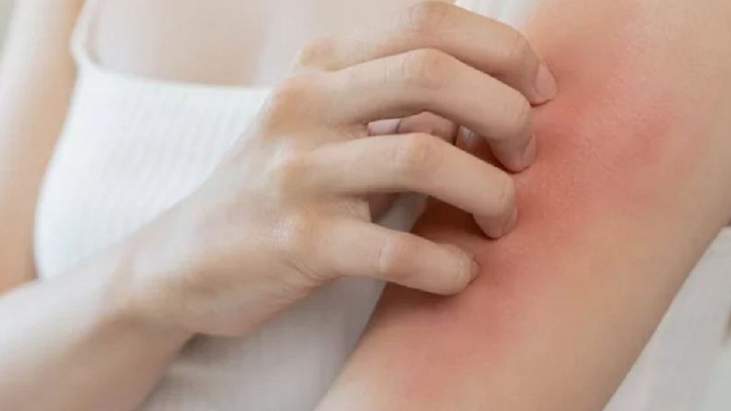 Lá xoan giúp điều trị ngứa ngoài da