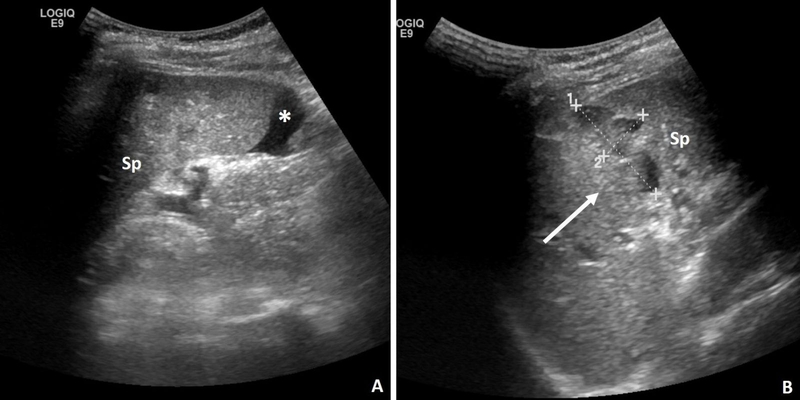 Lách to có mấy độ, phân biệt như thế nào? 3