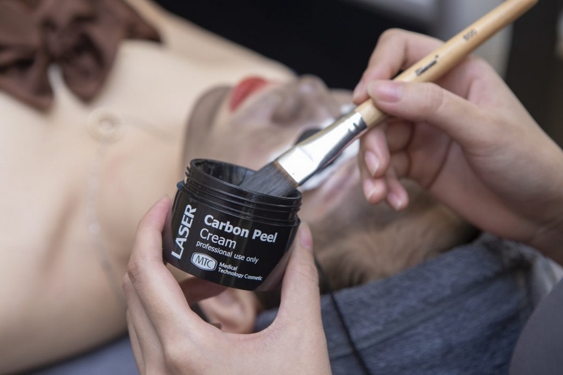 Làm đẹp bằng bắn than hoạt tính có tác dụng gì? Cần lưu ý gì nếu sử dụng phương pháp này? 2