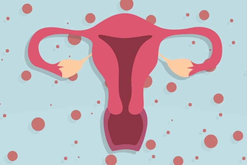 Trễ kinh 1 tháng do bệnh lý