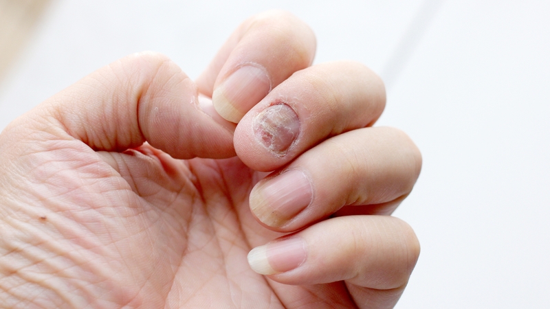 Mẹ bầu làm nail có ảnh hưởng đến thai nhi không là thắc mắc của nhiều người 1