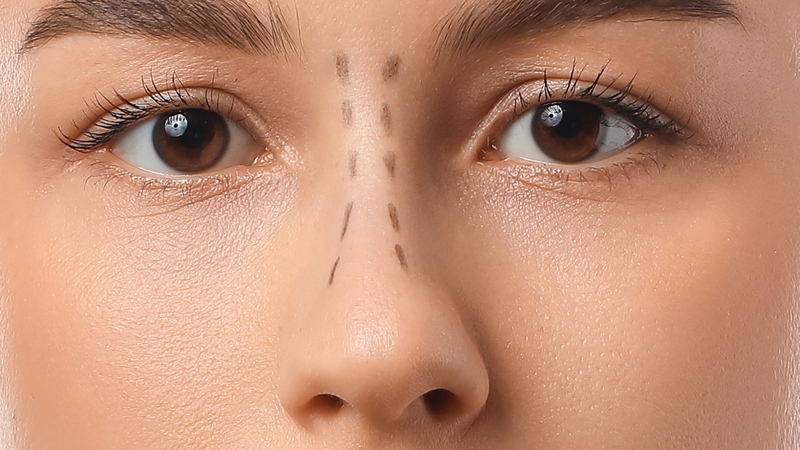 Làm sao để biết mũi cao hay thấp? So sánh tỷ lệ mũi với khuôn mặt