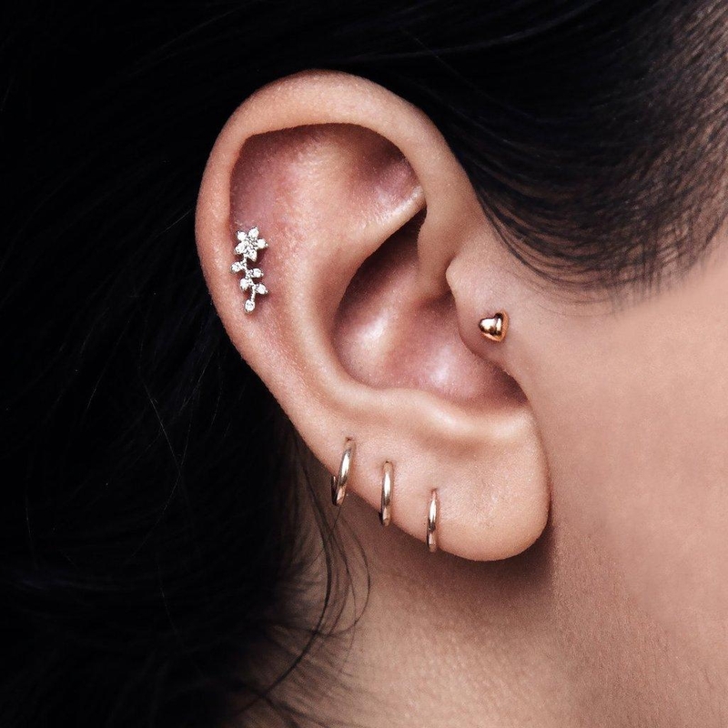 Làm sao để loại bỏ sẹo lồi khi xỏ khuyên 1