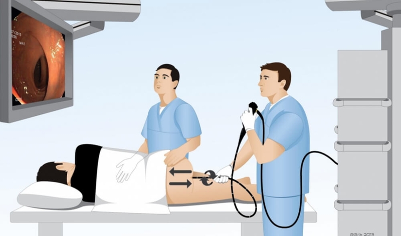 Làm sao để phòng ngừa và điều trị bệnh trĩ? 4