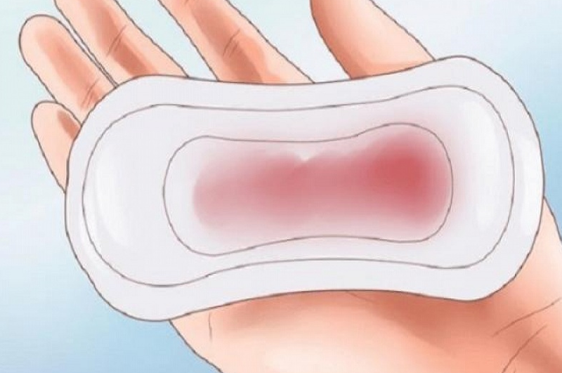 Ra khí hư màu nâu sau kỳ kinh nguyệt có thể do nguyên nhân bệnh lý