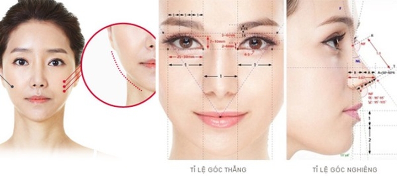 Làm sao khi độn cằm bị lệch? Cách khắc phục cằm lệch 2