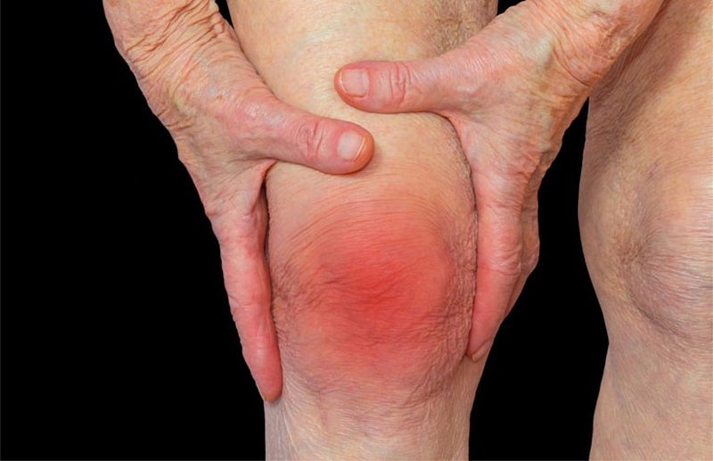 Nguyên nhân gây&nbsp;đau khớp gối&nbsp;thường do bệnh liên quan đến khớp gối