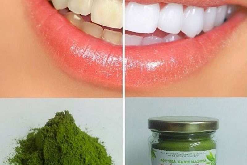 Làm trắng răng bằng trà xanh có hiệu quả không
