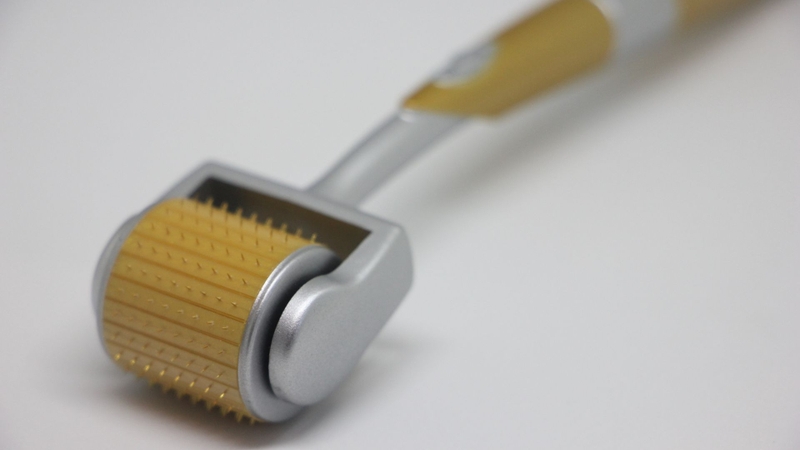 Với phương pháp lăn kim trị sẹo rỗ, các vết lõm được kích thích làm đầy nhờ sự tái tạo collagen