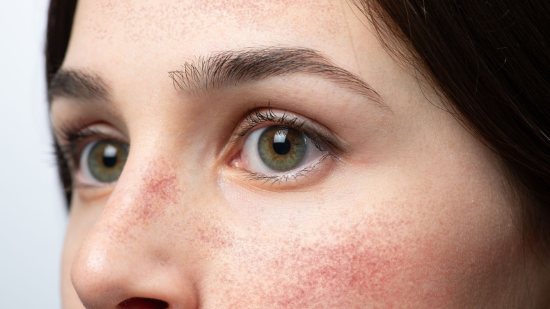 Nếu quy trình không đảm bảo vô khuẩn có thể dẫn đến viêm da nặng