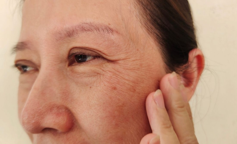 Lão hóa ngoại sinh là gì? Nguyên nhân, biểu hiện, cách khắc phục 2