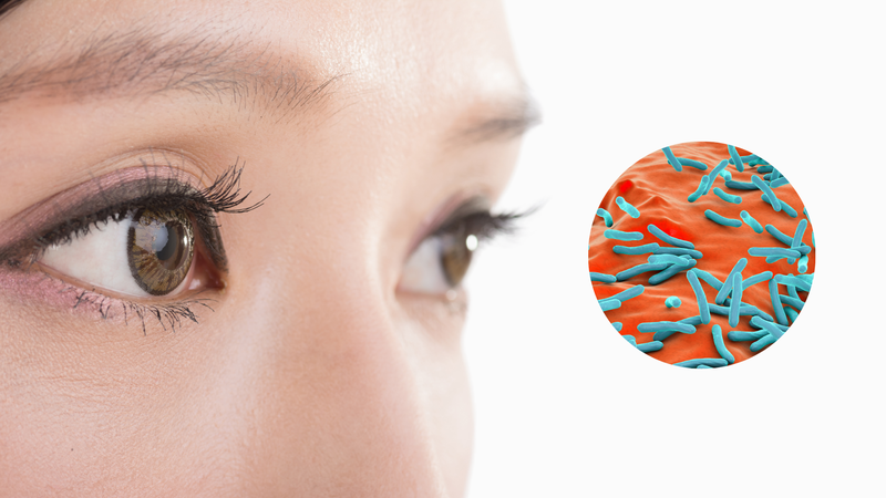 Lao ở mắt: Những điều cần biết để bảo vệ cửa sổ tâm hồn của bạn 1