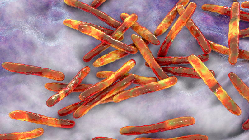 Lao xương khớp háng là tình trạng nhiễm trùng tại khớp háng do vi khuẩn Mycobacterium tuberculosis gây ra