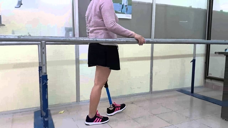 Lắp chân giả: Các bước cần chuẩn bị và lộ trình thực hiện 2