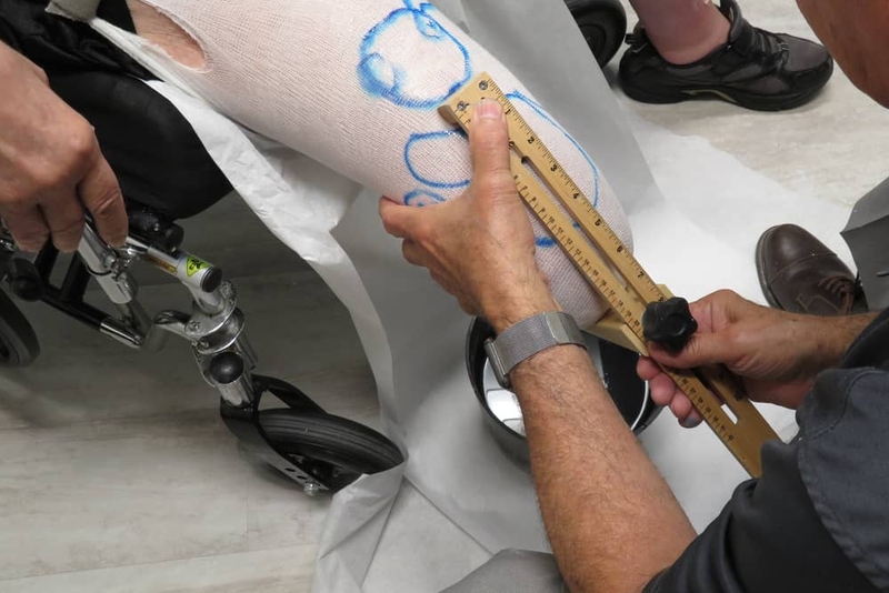 Lắp chân giả: Các bước cần chuẩn bị và lộ trình thực hiện 3