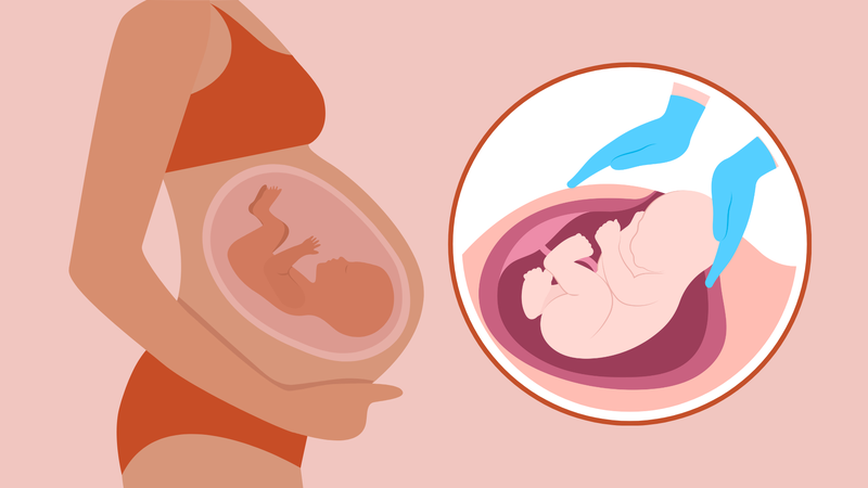 Lập kế hoạch chăm sóc sản phụ sau mổ đẻ: Hành trình phục hồi sau sinh 1