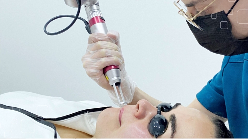 Laser pico có ưu điểm gì trong thẩm mỹ da 4
