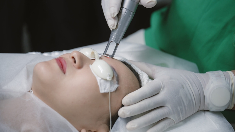 Laser Toning giúp điều trị nám, tàn nhang