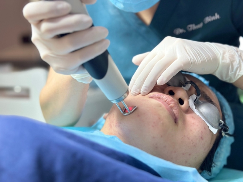 laser-yag-la-gi-ung-dung-cua-cong-nghe-laser-yag-trong-tham-my 2.jpg