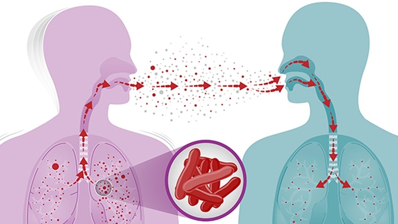 Lây nhiễm thứ phát là gì? Tìm hiểu về cơ chế lây lan bệnh trong cộng đồng 3